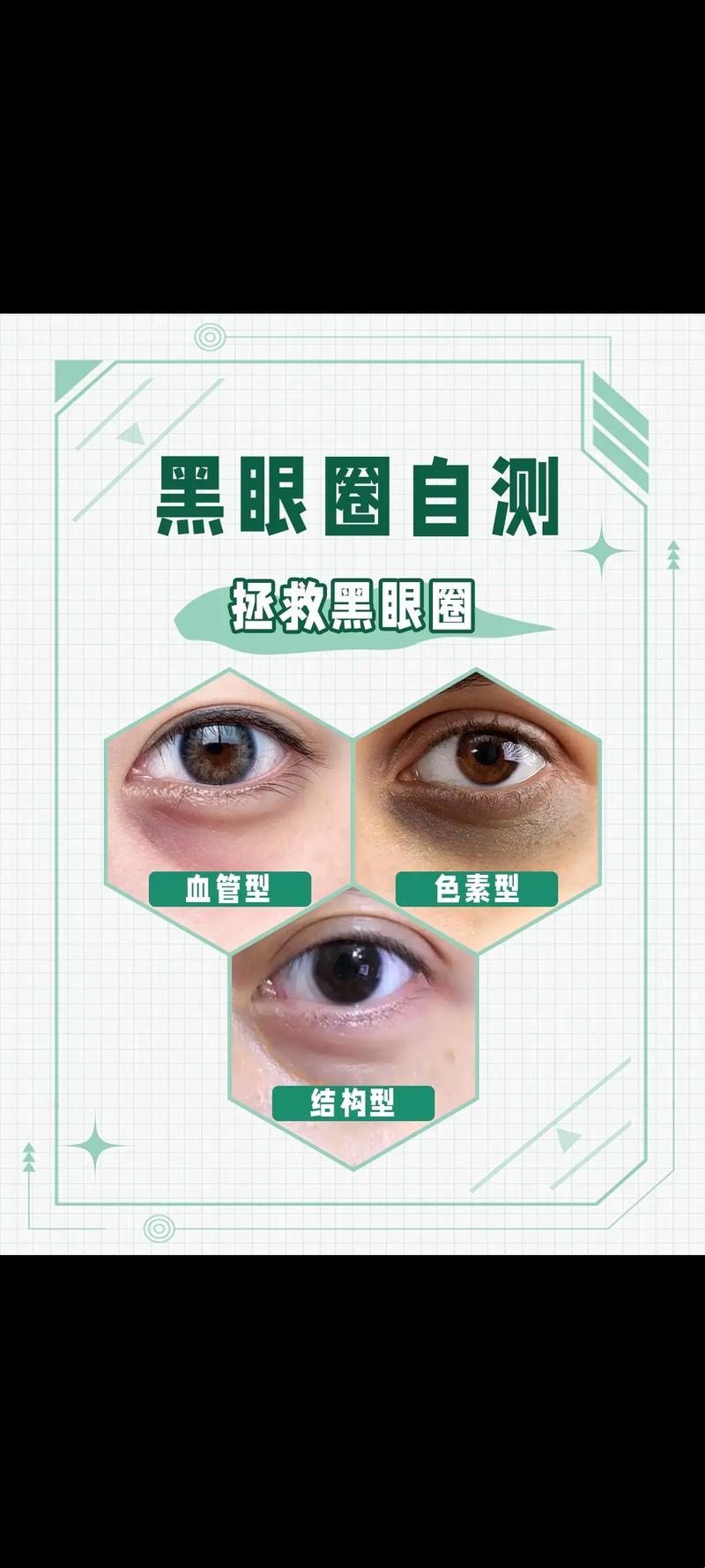 “熊猫眼”=病秧子？笑话，这可是时尚界的宠儿！