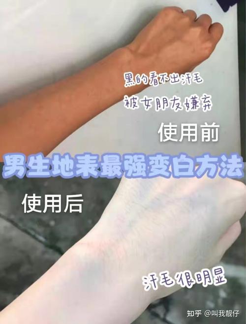 男子汉变白攻略：笑看医美风潮