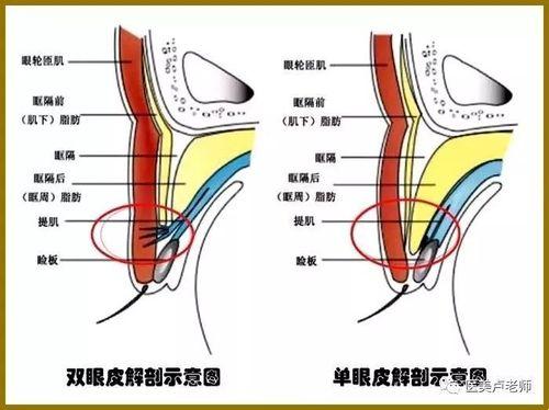 《双眼皮儿：皮下之谜与情感地图》